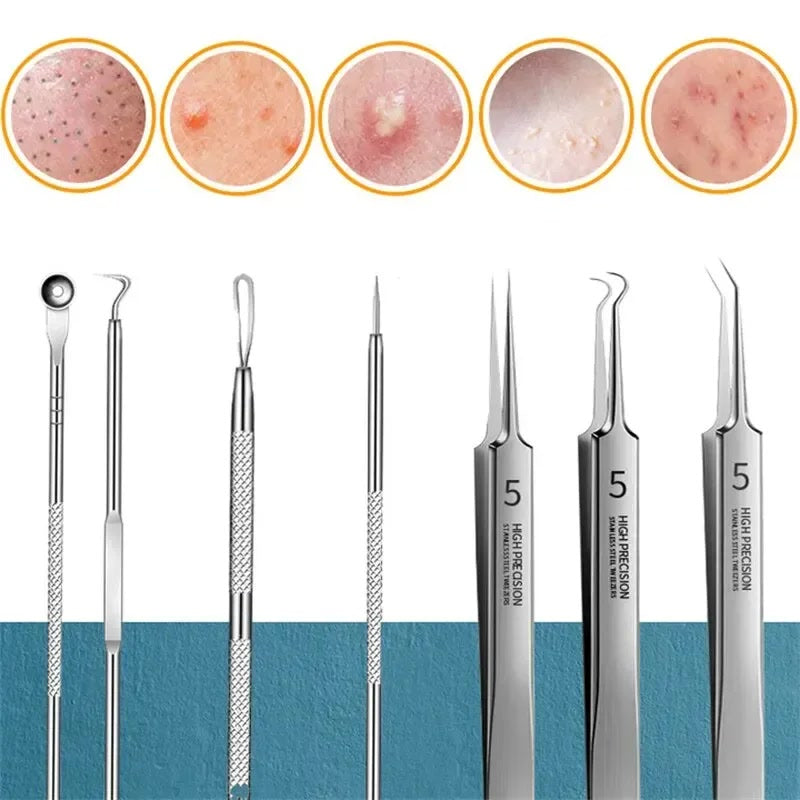 11pcs/set Acne Needle Blackhead Clip Remover Extraction Pore Face Skin Care Cleansing Double Headed Needles Blemish Removal Tool