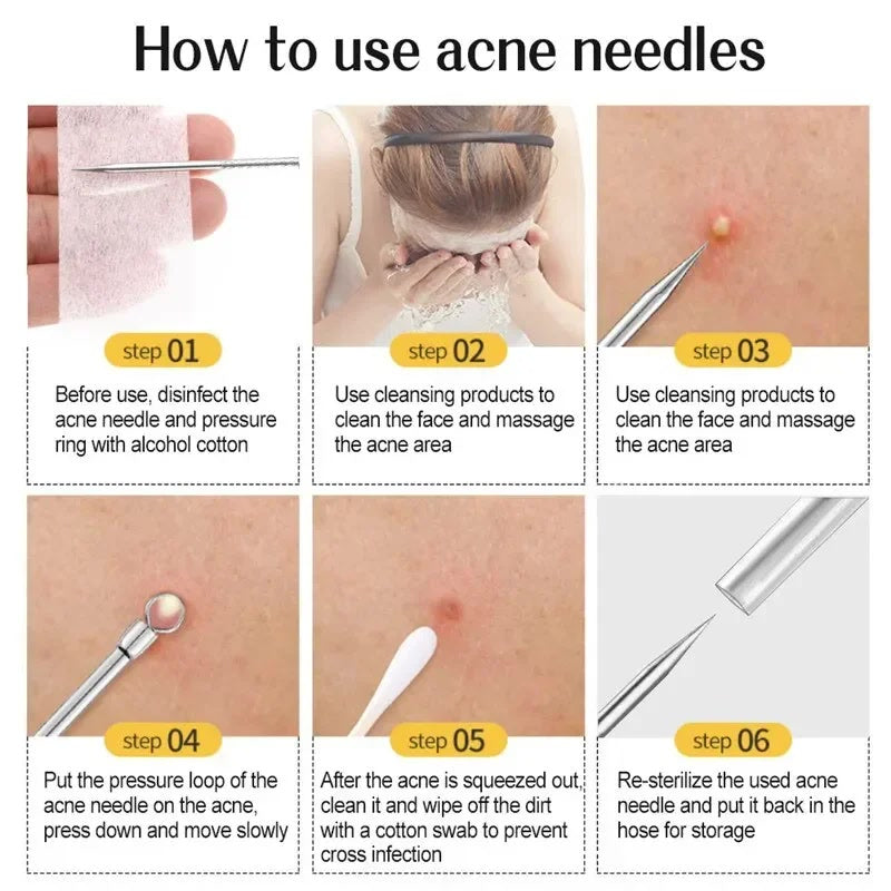 11pcs/set Acne Needle Blackhead Clip Remover Extraction Pore Face Skin Care Cleansing Double Headed Needles Blemish Removal Tool