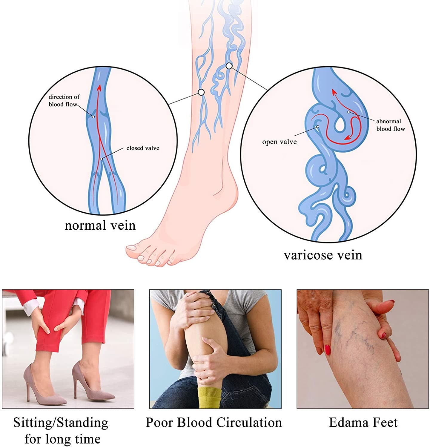 Medical Compression Pantyhose for Women 30-40 MmHg Compression Stockings Varicose Veins Thigh High Compression Stockings
