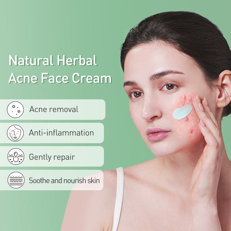 JoyPretty Herbal Skin Care Set Acne Face Cream Tea Tree Serum Treatment Pimple Removal Moisturizing Facial Products Kits 2PCS
