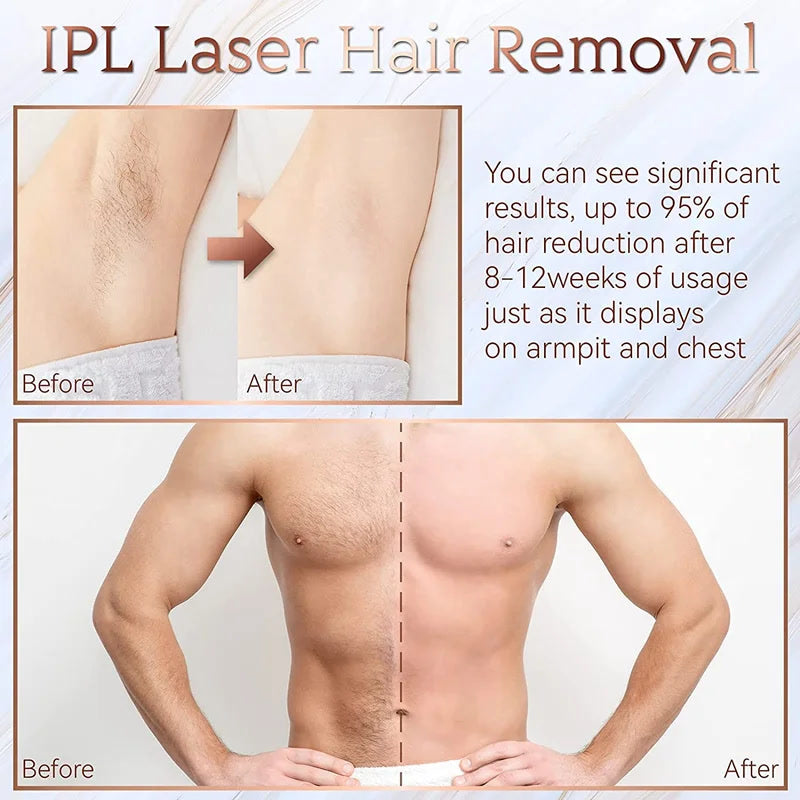New In 999999 Flashes Laser Epilator Laser Hot Sell Permanent IPL Photoepilator Hair Removal Painless Electric Epilator Machine